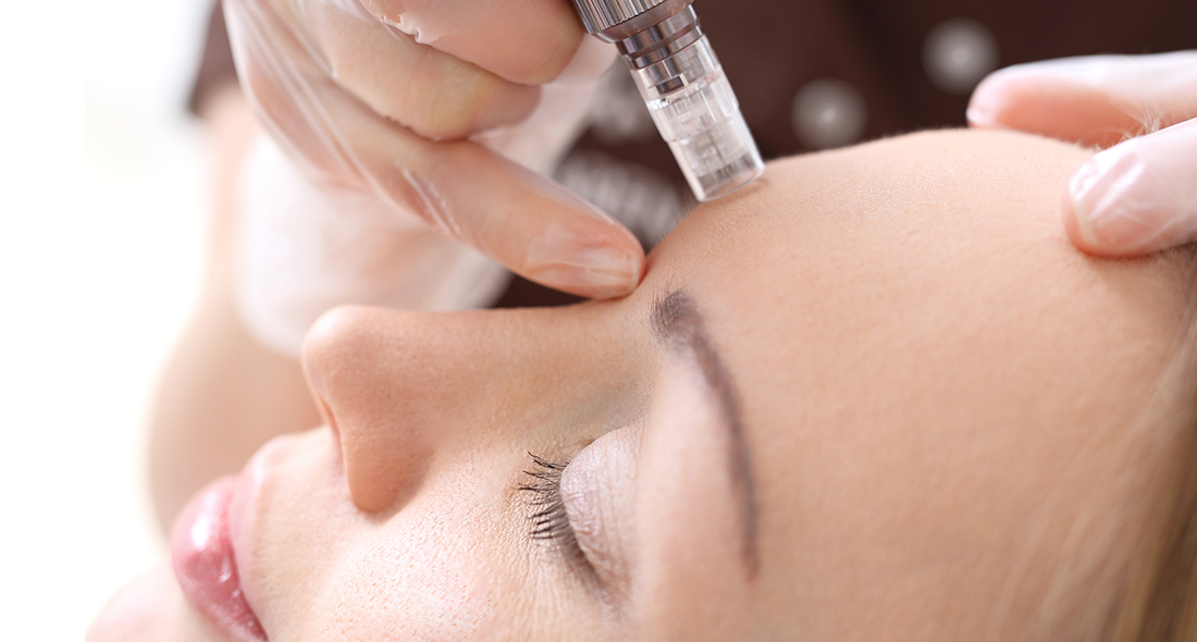 Microneedling-Web Microneedling-Web