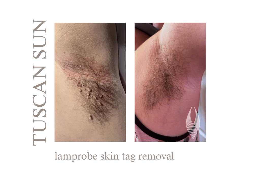 Lamprobe